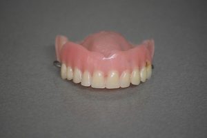 Zobne luske se namestijo z dokaj enostavnim postopkom, a nekatere možnosti beljenja so tudi bolj preproste